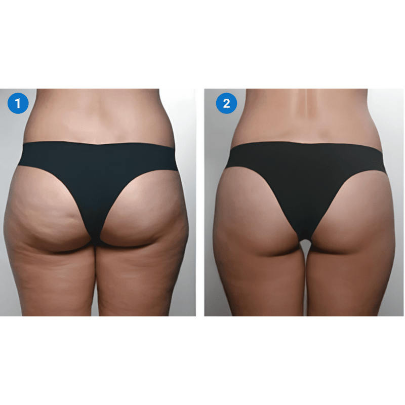 Creme de Pele Anti-Rugas e Flacidez Fubsta®