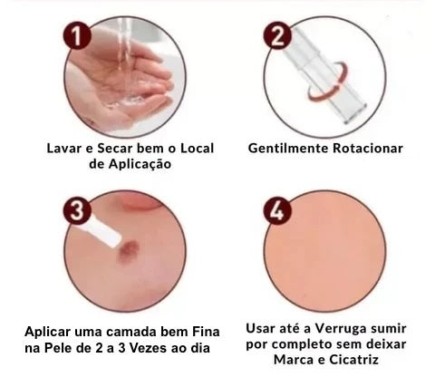 WipeOff - Trate as Verrugas, Manchas e Marcas com Ingredientes Naturais!